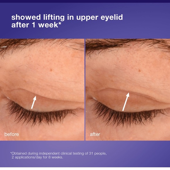 Dermalogica Phyto Nature Lifting Eye Cream 15ml - Picture 8 of 11